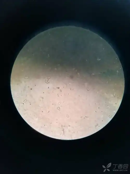 请各位老师看一下,这是尿里面的结晶,个人觉得是尿酸结晶又觉得不怎么