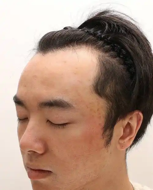 原创网友称华晨宇是自己老公还晒出多张华晨宇植发照片称张碧晨是小三