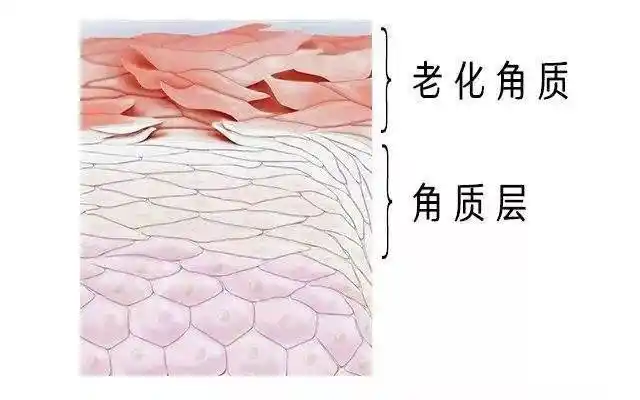 黑头,肤色不匀,肤色暗沉,很大原因都是角质层堆积导致 的.