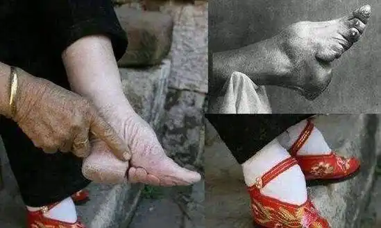 古代女子缠脚风俗的兴衰史,为何古人以"三寸金莲"形容小脚?