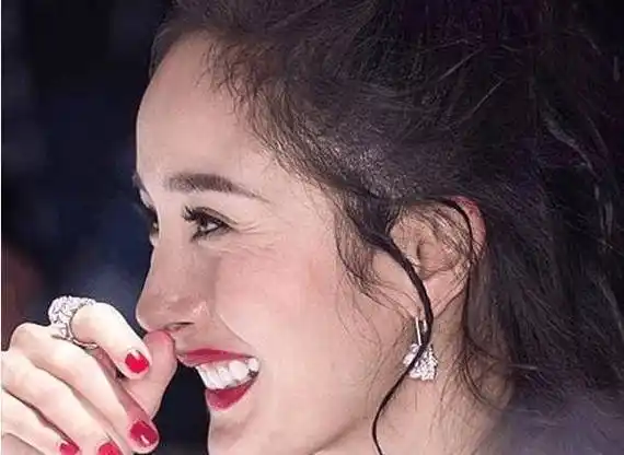 原创杨幂随手一晒的黄金眼贴李佳琪也在用专治眼圈大眼袋