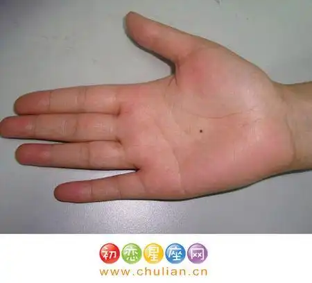 手背痣运势 手背痣的位置与命运