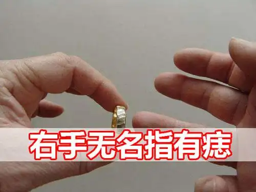 右手无名指有痣有什么含义