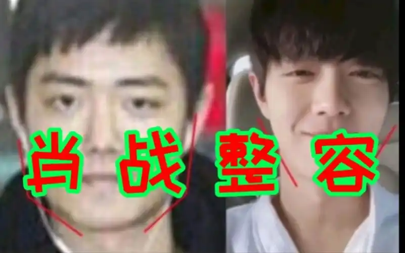 活动作品肖战整容实锤带你们看看她都整了啥