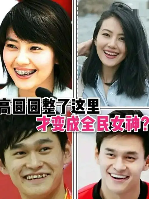 大家不难发现,很多的明星都会去牙科做牙齿矫正,因为牙齿矫正对颌面的