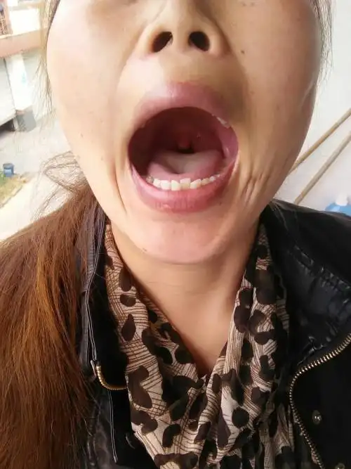总是感觉左侧好像有东西,阴痛阴痛的,到中午的时候喉咙也有点痛,是