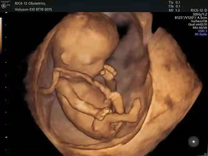 四维单上有三条线会不会是儿子