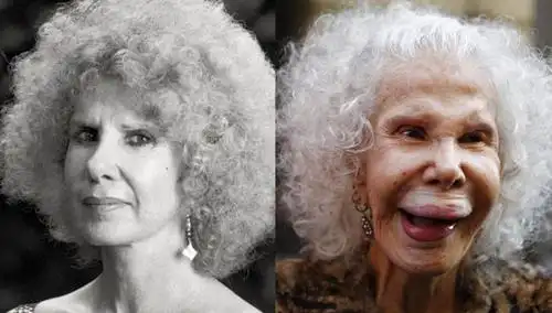 10大整容失败,女神变恐怖"鬼新娘"的悲惨女明星