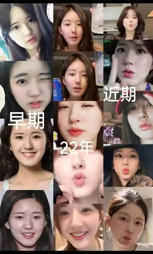 突然发现赵露思好恐怖啊!|瘦脸|眉弓|医美|眉心|整容_网易订阅