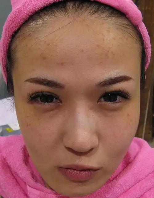 肤色不均,皮肤白,黄,黑,红混杂,怎么办?