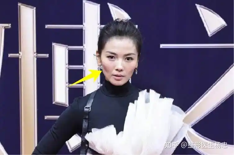 为什么刘涛的脸忽然就陷下去了