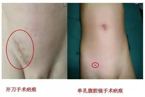 家有男宝宝,孩子出现这个症状别大意