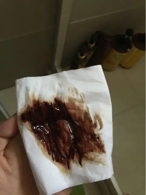 回答 您好,根据您以上详细描述的,您目前的情况考虑应该是腹痛出血