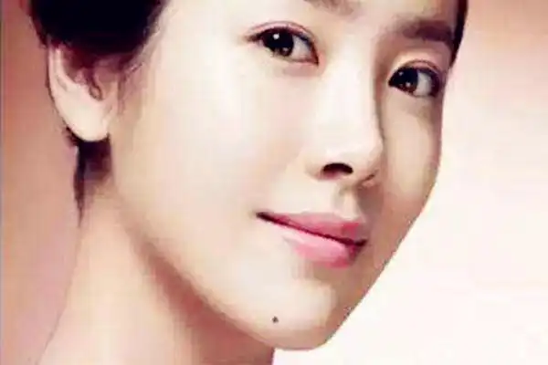 女人左下巴有痣好吗