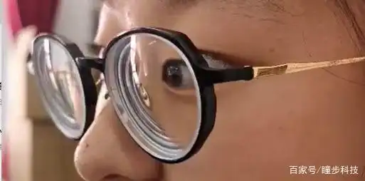 年级越高近视率越比重越大,且高度近视的占比逐步增大,近视发病年龄