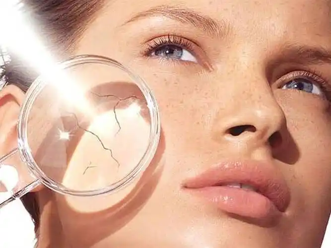 脸干燥脱皮紧绷是什么原因?很多人不清楚,看完你就知道了!_肌肤