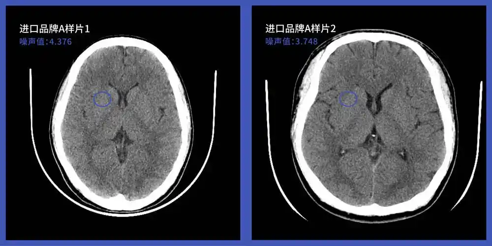 皓月ct头颅图像技术和样片分享