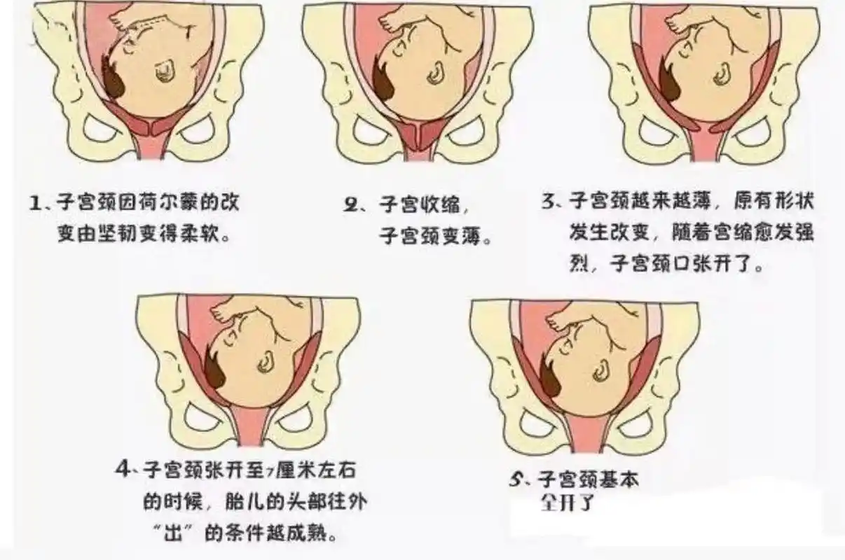 胎儿入盆是什么样的 胎儿入盆究竟是什么感觉?