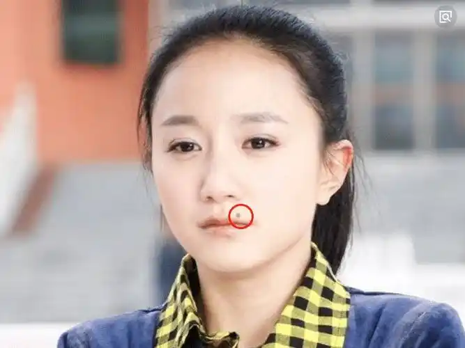因为嘴角的痣被关注出道18年不温不火将痣点掉后事业攀升