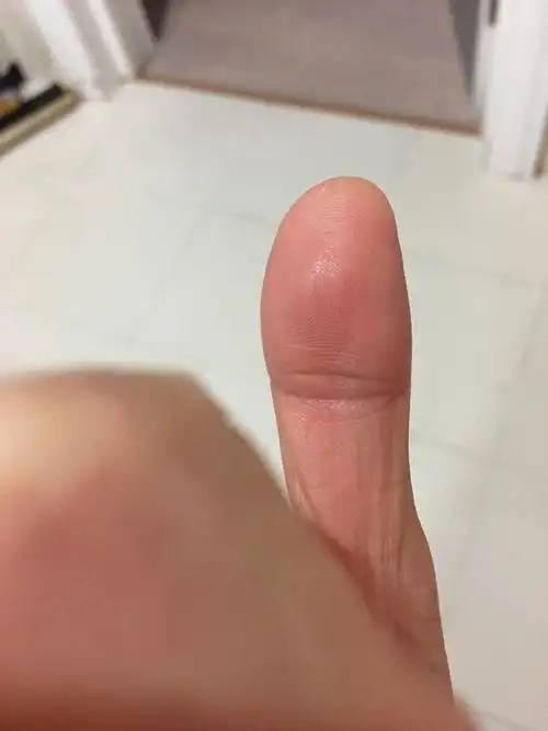 我这个是不是凤眼纹,两边没封住?