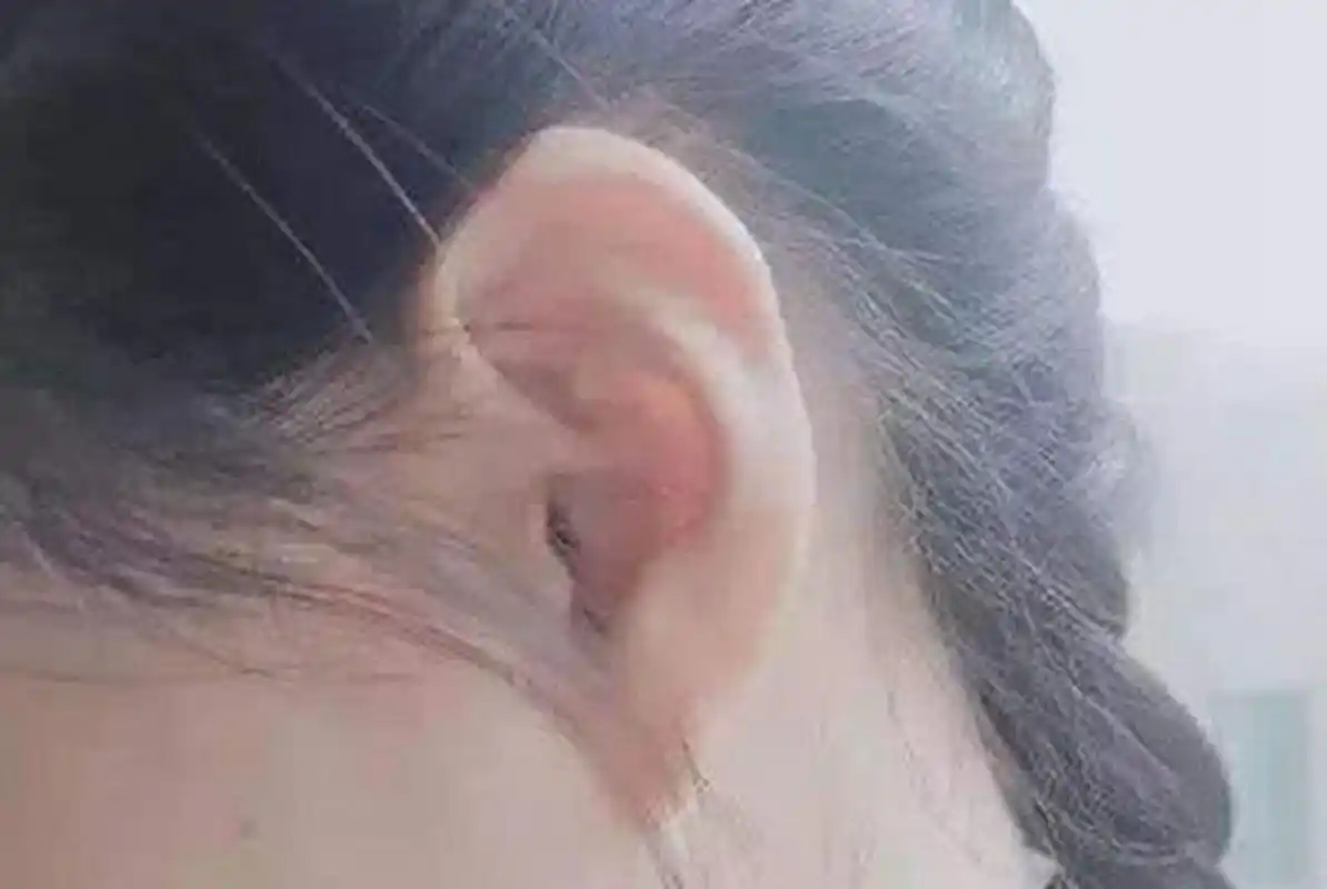 你的耳朵是啥样