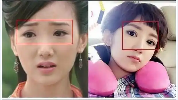 毛晓彤到底整了吗?