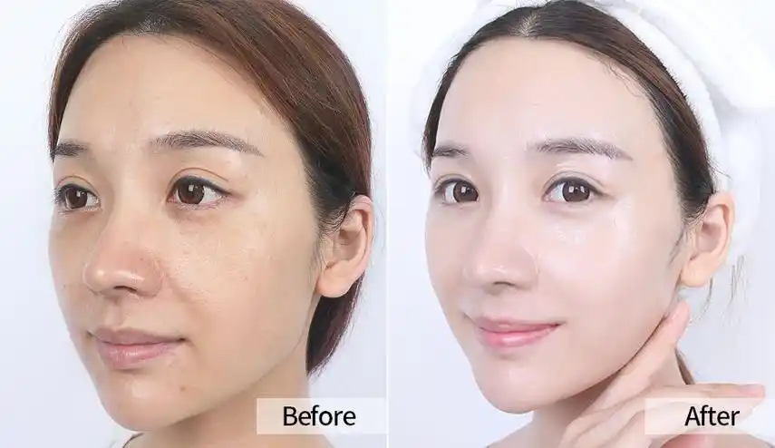 让皮肤一夜回春的日本护肤黑科技,整个娱乐圈都在用