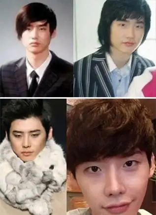 李钟硕承认整容 整容前的照片被爆出