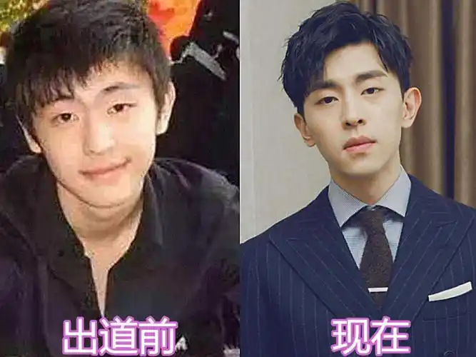 当红男星出道前vs后:张艺兴胖嘟嘟,邓伦变化大,肖战开挂逆袭