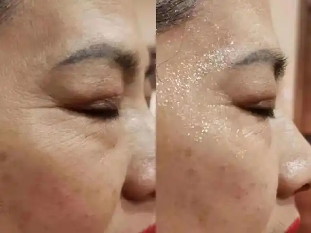 为什么皮肤会衰老怎么抗衰老