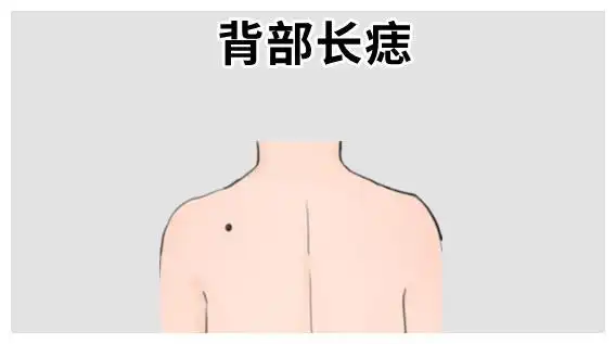 身体4颗破财痣大钱无小钱光一分钱也留不住后半生穷