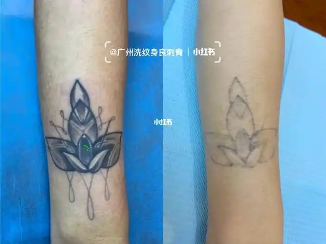 洗纹身三次效果对比