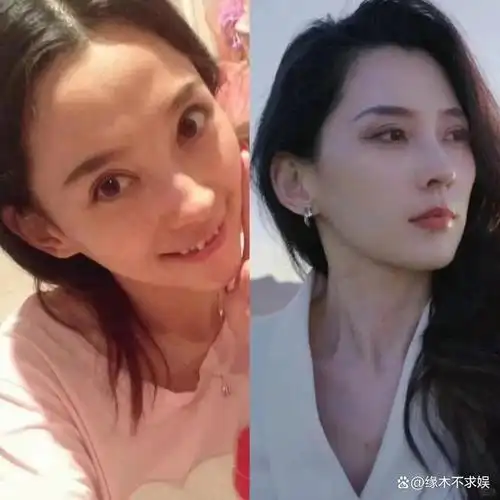 汪峰女友被曝整容,整形医生晒其海量旧照,本人回应!