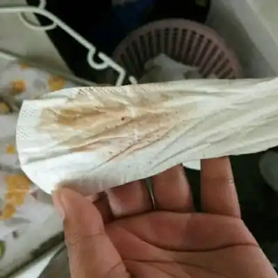 属於着床期出血吗