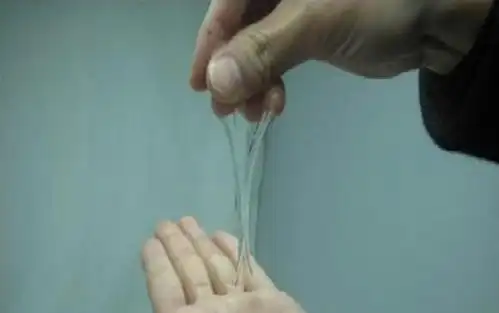 女性在排卵期最常见的表现是分泌物会增多,医生通常会检查"宫颈粘液"