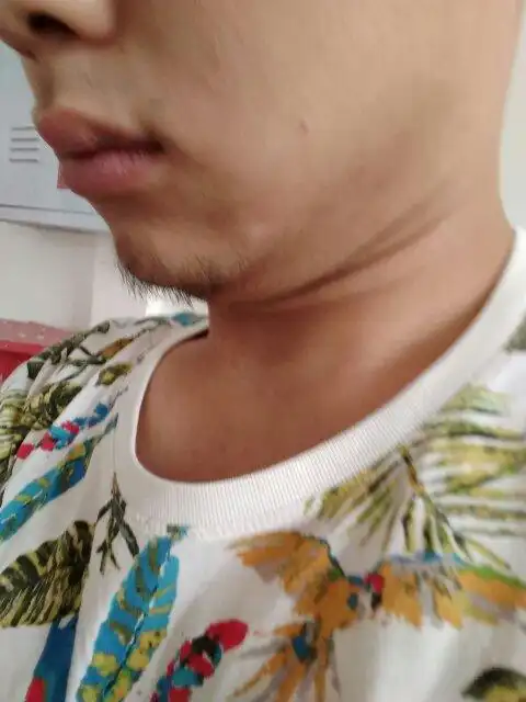 双下巴,和脸庞肉,怎么减掉!我是个脸不容易出汗的人