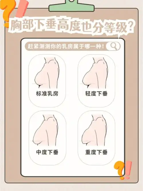 胸下垂还有等级之分你在哪一级71