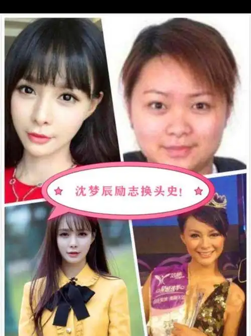 长开式"整形" 沈梦辰的整容史,真堪称励志