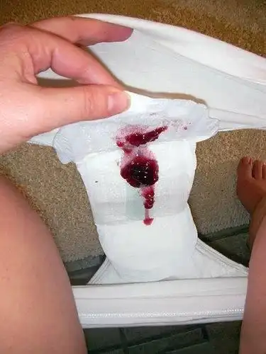 女生卫生巾上的血,新鲜的带血的卫生巾-图片大观-奇异网