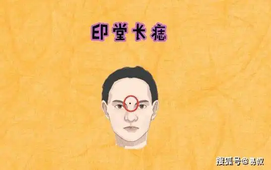 身体5颗"巨富"痣,只要有一个,腰缠万贯,万里挑一的好命