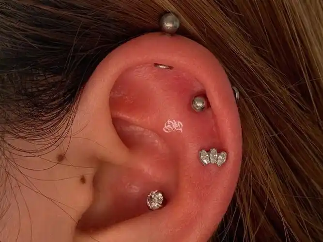 外耳轮70153 / 耳蜗70151徒手穿刺 98肿胀 98出00均为