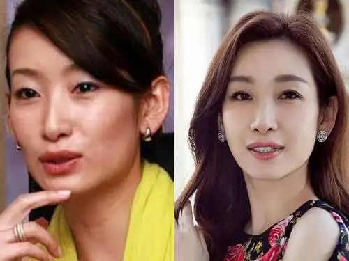 盘点割过双眼皮的明星