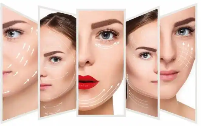 上海美莱smart面部精雕技术~青春定格