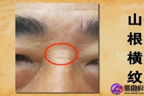 鼻粱上有一条横纹