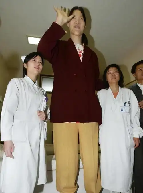 世界最高女人姚德芬:身高2.36米的坎坷人生