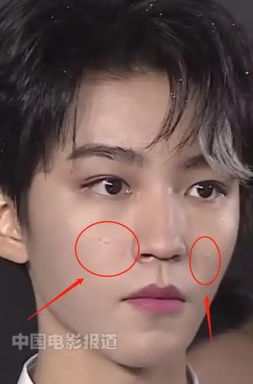 王俊凯挑染刘海帅?无精修怼脸生图说明一切,真实状态细节明显