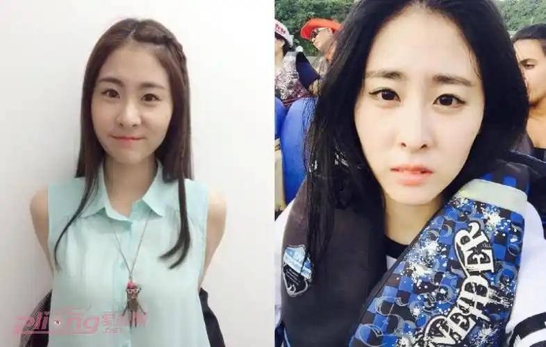 "中国好声音"张碧晨整容前后照片对比