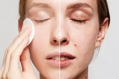 皮肤松弛下垂怎么办 自然兰6大方法解决松弛问题