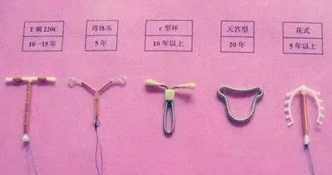 一般几个月后就能适应以上两种副作用如治疗无效,症状加重,可考虑取环