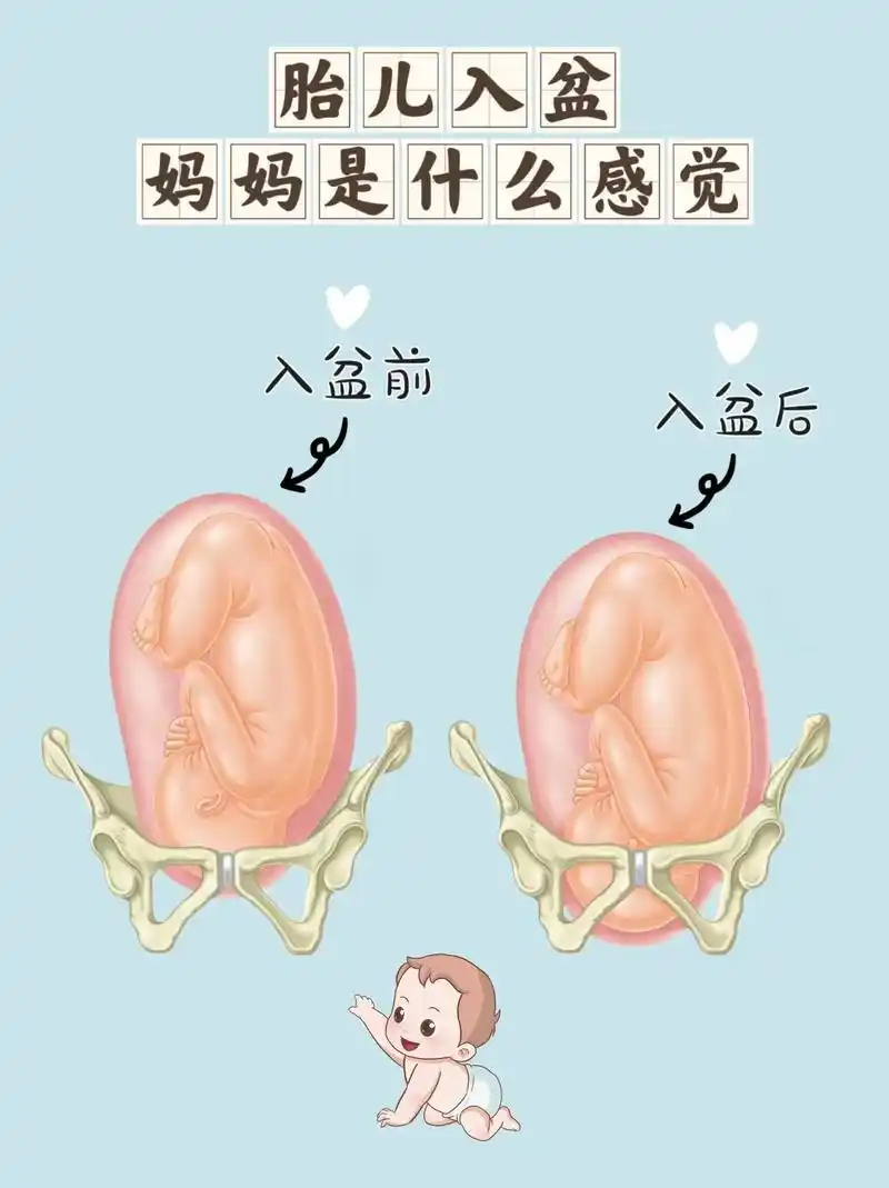 胎儿入盆时,孕妈有什么感觉?#怀孕 #胎儿入盆有什么反应 # - 抖音